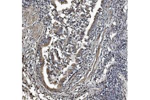 IHC analysis of REA/PHB2 using anti-REA/PHB2 antibody (ABIN7599239).