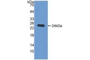 Detection of Recombinant GAMT, Human using Polyclonal Antibody to Guanidinoacetate-N-Methyltransferase (GAMT) (GAMT antibody  (AA 64-236))