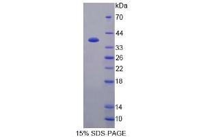 Image no. 1 for Amyloid beta Precursor Protein Binding Protein 1 (AA 229-534) protein (His tag) (ABIN6239155) (Amyloid beta Precursor Protein Binding Protein 1 (AA 229-534) protein (His tag))