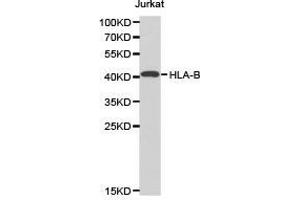 Western Blotting (WB) image for anti-Major Histocompatibility Complex, Class I, B (HLA-B) antibody (ABIN1873025)
