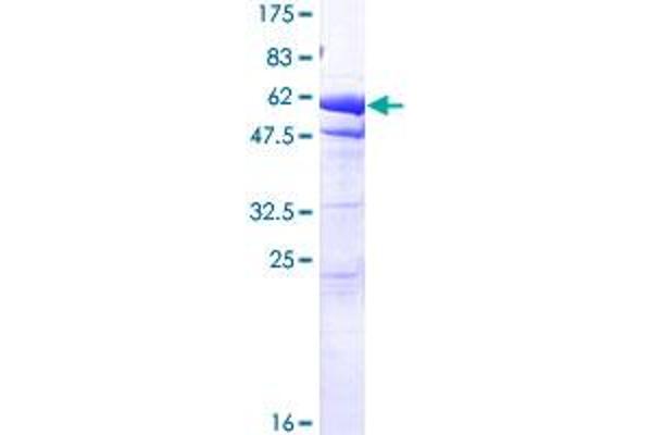 EEF1D Protein (AA 1-281) (GST tag)