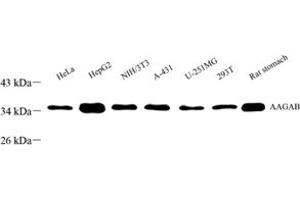 Western blot analysis of FLJ11506 (ABIN7073019) at dilution of 1: 1000 (AAGAB antibody)