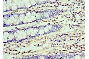 Immunohistochemistry of paraffin-embedded human colon tissue using ABIN7174370 at dilution of 1:100 (UCHL3 antibody  (C-Term))