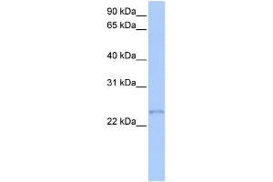 WB Suggested Anti-TCEAL1 Antibody Titration:  0.