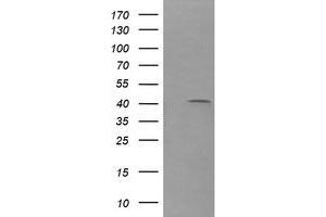 Image no. 2 for anti-Parvin, alpha (PARVA) antibody (ABIN1496443) (Parvin alpha antibody)