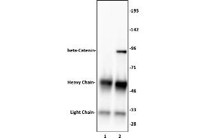 beta-Catenin antibody (pAb) tested by Immunoprecipitation. (beta Catenin antibody  (N-Term))