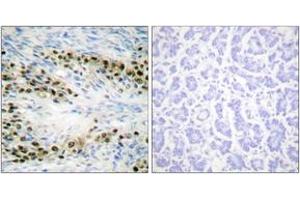 Immunohistochemistry analysis of paraffin-embedded human ovary tissue, using Akt (Ab-72) Antibody. (AKT1 antibody  (AA 38-87))