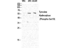 Western Blot (WB) analysis of specific cells using Phospho-TH (S19) Polyclonal Antibody. (TH antibody  (pSer19))