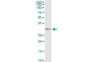 PRKG1 MaxPab rabbit polyclonal antibody. (PRKG1 antibody  (AA 1-312))