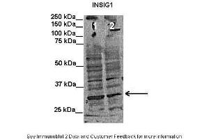 Lanes:   Lane1: 50 ug human putamen lysate Lane2: 50 ug rat cortex lysate  Primary Antibody Dilution:   1:1000  Secondary Antibody:   Mouse anti-rabbit HRP  Secondary Antibody Dilution:   1:15000  Gene Name:   INSIG1  Submitted by:   Anonymous (INSIG1 antibody  (Middle Region))
