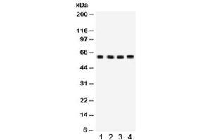 Western blot testing of 1) human placenta, 2) HepG2, 3) 293 and 4) HeLa lysate with HRPT2 antibody. (HRPT2 antibody  (AA 119-520))