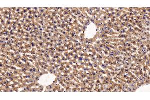 Detection of FUR in Mouse Liver Tissue using Polyclonal Antibody to Furin (FUR) (FURIN antibody  (AA 418-573))