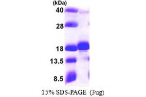 SDS-PAGE (SDS) image for Ubiquitin-Conjugating Enzyme E2W (UBE2W) (AA 1-151) protein (His tag) (ABIN667464) (UBE2W Protein (AA 1-151) (His tag))