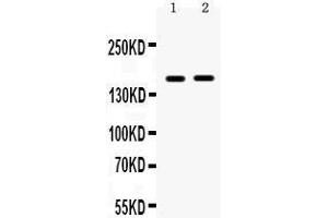Observed bind size: 160KD (HDAC6 antibody  (N-Term))