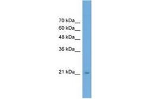 Image no. 1 for anti-RAB25, Member RAS Oncogene Family (RAB25) (AA 107-156) antibody (ABIN6746507) (RAB25 antibody  (AA 107-156))