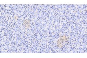 Detection of XRN1 in Human Pancreas Tissue using Polyclonal Antibody to 5'-3'Exoribonuclease 1 (XRN1) (XRN1 antibody  (AA 1394-1706))