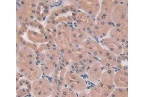 Used in DAB staining on fromalin fixed paraffin- embedded kidney tissue (PTPN13 antibody  (AA 1-161))