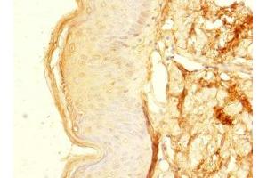 Immunohistochemistry of paraffin-embedded human skin tissue using ABIN7176351 at dilution of 1:100 (ZNF513 antibody  (AA 1-300))