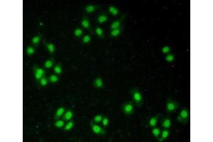 Detection of NUP50 in Hela cells using Polyclonal Antibody to Nucleoporin 50 kDa (NUP50) (NUP50 antibody  (AA 37-269))