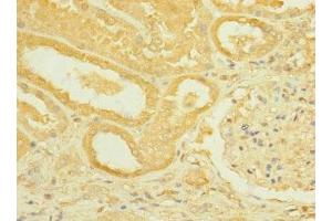 Immunohistochemistry of paraffin-embedded human kidney tissue using ABIN7168444 at dilution of 1:100