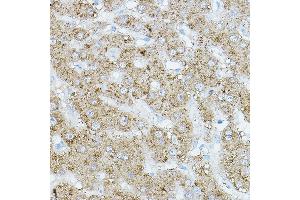 Immunohistochemistry of paraffin-embedded human liver using EIF2 Rabbit pAb (ABIN6131600, ABIN6140021, ABIN6140022 and ABIN6218371) at dilution of 1:500 (40x lens). (EIF2AK1 antibody  (AA 371-630))