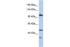 WB Suggested Anti-XAB2 Antibody Titration:  0. (XAB2 antibody  (N-Term))
