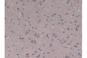 Immunohistochemistry (IHC) image for anti-Complement Component 5a (C5a) (AA 678-751) antibody (ABIN7442321)