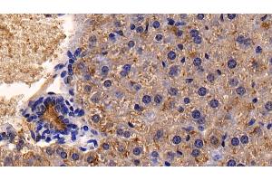 Detection of CD26 in Mouse Liver Tissue using Polyclonal Antibody to Cluster Of Differentiation 26 (CD26) (DPP4 antibody  (AA 631-760))