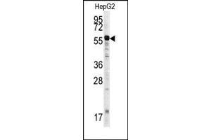 Image no. 1 for anti-Matrix Metalloproteinase 20 (MMP20) (Middle Region) antibody (ABIN358692) (MMP20 antibody  (Middle Region))