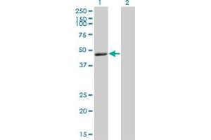 Western Blot analysis of TNFRSF19L expression in transfected 293T cell line by TNFRSF19L monoclonal antibody (M01), clone 3F8.