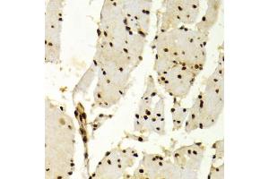 Immunohistochemistry of paraffin-embedded human esophagus using KPNA4 Antibody (ABIN5971058) at dilution of 1/100 (40x lens).