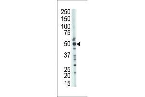 The anti-TSABIN486223 and ABIN1535604 Pab (ABIN388926 and ABIN2839200) is used in Western blot to detect TSABIN486223 and ABIN1535604 in mouse kidney tissue lysate. (TSG101 antibody  (N-Term))