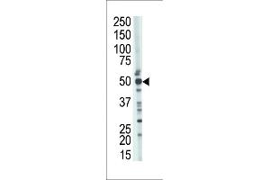 The anti-TSABIN486223 and ABIN1535604 Pab (ABIN388926 and ABIN2839200) is used in Western blot to detect TSABIN486223 and ABIN1535604 in mouse kidney tissue lysate. (TSG101 antibody  (N-Term))