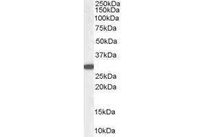 Western Blotting (WB) image for anti-NAD(P)H Dehydrogenase, Quinone 1 (NQO1) (C-Term) antibody (ABIN184714)