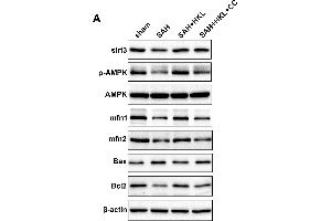 SIRT3 protected mitochondrial fusion proteins Mfn1 and Mfn2 after SAH in an AMPK-dependent manner. (MFN1 antibody  (AA 622-741))