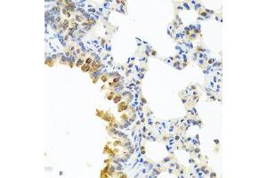 Immunohistochemistry of paraffin-embedded mouse lung using SERPINA3 antibody at dilution of 1:100 (40x lens). (SERPINA3 antibody)