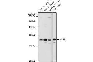 Western blot analysis of extracts of various cell lines, using VAPB antibody (ABIN6132783, ABIN6150058, ABIN6150059 and ABIN6221003) at 1:1000 dilution. (VAPB antibody  (AA 10-222))