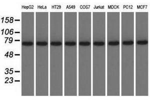 Image no. 2 for anti-Kelch Repeat and BTB (POZ) Domain Containing 7 (KBTBD7) antibody (ABIN1498995) (KBTBD7 antibody)