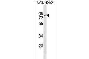 ZN Antibody (Center) (ABIN1538077 and ABIN2849760) western blot analysis in NCI- cell line lysates (35 μg/lane). (ZNF551 antibody  (AA 208-235))