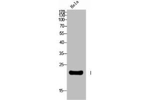 Western Blot analysis of HELA cells using Neurotensin Polyclonal Antibody (Neurotensin antibody  (C-Term))