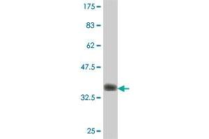 Western Blot detection against Immunogen (37. (RHBDL1 antibody  (AA 1-100))