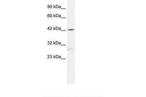 Image no. 1 for anti-SRY (Sex Determining Region Y)-Box 5 (SOX5) (C-Term) antibody (ABIN6735837) (SOX5 antibody  (C-Term))