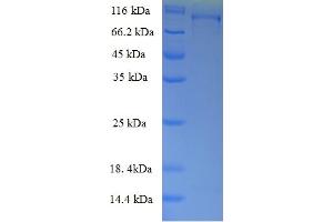 SDS-PAGE (SDS) image for 5-Methyltetrahydrofolate-Homocysteine Methyltransferase Reductase (MTRR) (AA 1-725), (full length) protein (GST tag) (ABIN5711940) (MTRR Protein (AA 1-725, full length) (GST tag))