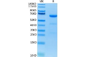 Human CD73 on Tris-Bis PAGE under reduced condition. (CD73 Protein (AA 27-547) (His tag))