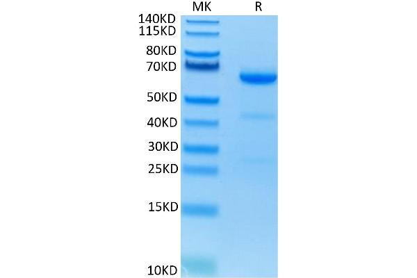 CD73 Protein (AA 27-547) (His tag)