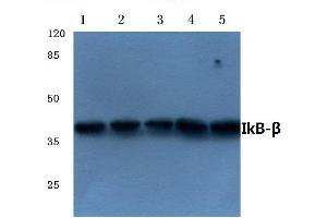 Western blot (WB) analysis of IkB-β antibody at 1/500 dilution (NFKBIB antibody)