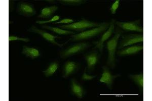 Immunofluorescence of purified MaxPab antibody to NFATC4 on HeLa cell.
