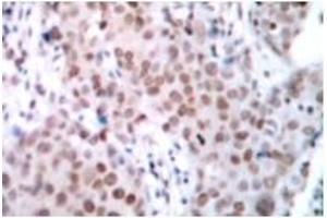Image no. 1 for anti-Estrogen Receptor 1 (ESR1) (pSer104) antibody (ABIN318016) (Estrogen Receptor alpha antibody  (pSer104))