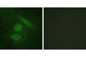Peptide - +Immunofluorescence analysis of HeLa cells, using IRF-3 (Ab-385) antibody. (IRF3 antibody  (Ser385))