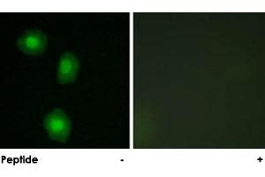 Immunofluorescence analysis of A-549 cells, using RPS6KA5 polyclonal antibody . (MSK1 antibody)